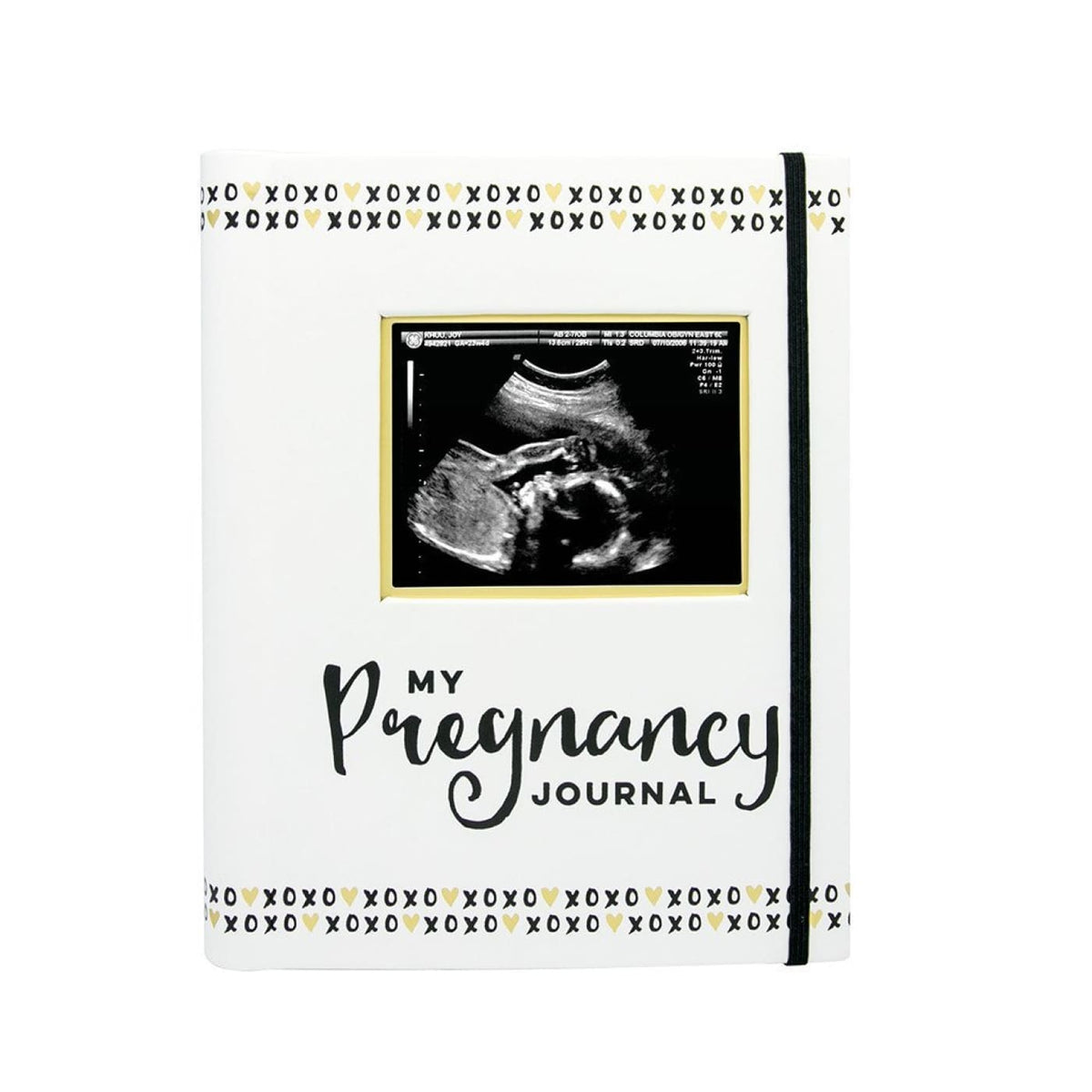 Pearhead My Pregnancy Journal - White/Black/Gold - GIFTWARE - KEEPSAKES
